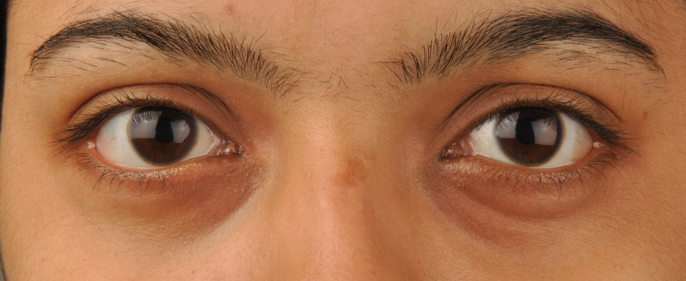eyes__nose_5783wikiw5fna.png